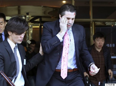 襲撃された直後のリッパート駐韓米大使＝ソウル EPA/YONHAP SOUTH KOREA OUT